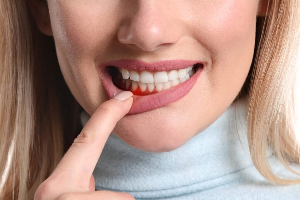 Gum disease prevention in Ealing guided by an experienced Ealing dentist for healthier gums and a confident smile